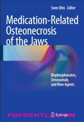 Medication-Related Osteonecrosis of the Jaws: Bisphosphonates, Denosumab, and New Agents (pdf)